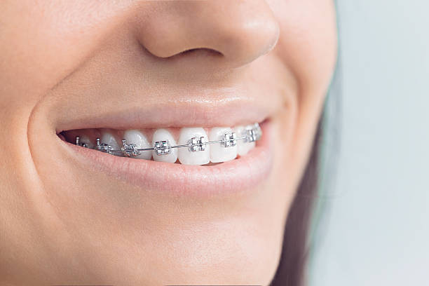 Best Traditional Braces  in Bethalto, IL